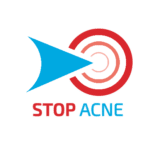 stop-acne